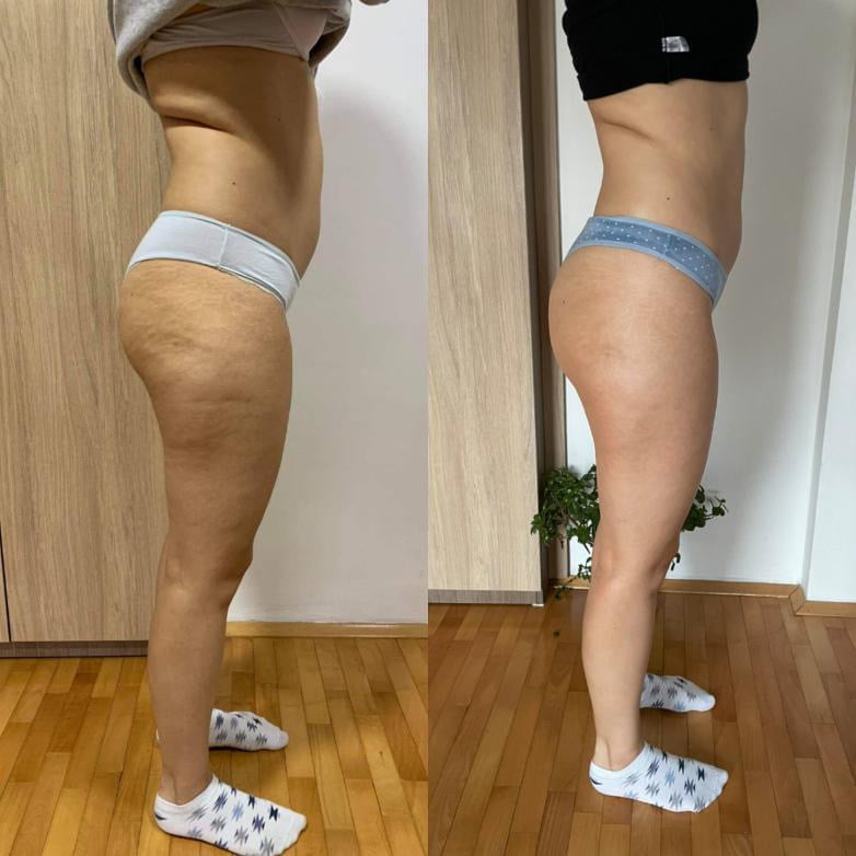 Före och efter Vacuslim 48, sida