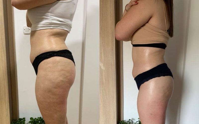 Före och efter Vacuslim 48 - sida